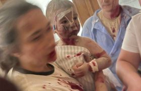 Головне Київ дитяча лікарня Охмадит